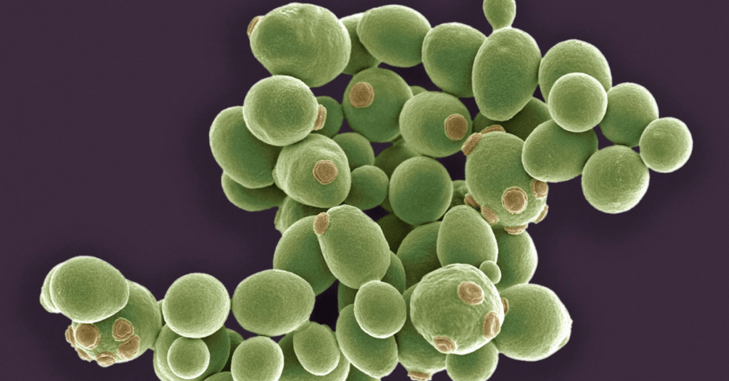 Fungi and Plant Cell&nbsp;Differences